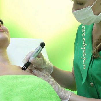 dermapen